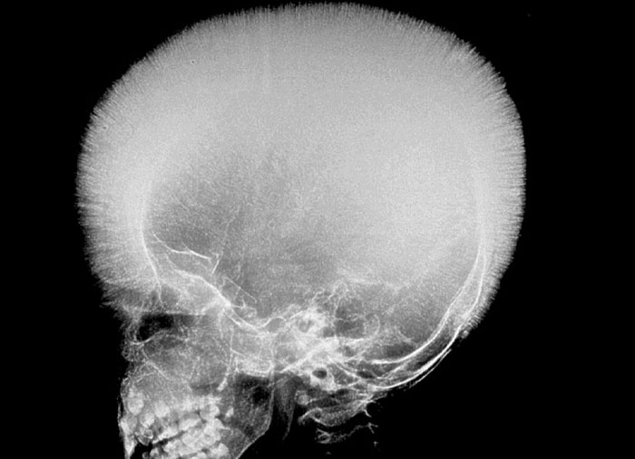 Past Mcq In Oral Pathology With Answers Focus Dentistry