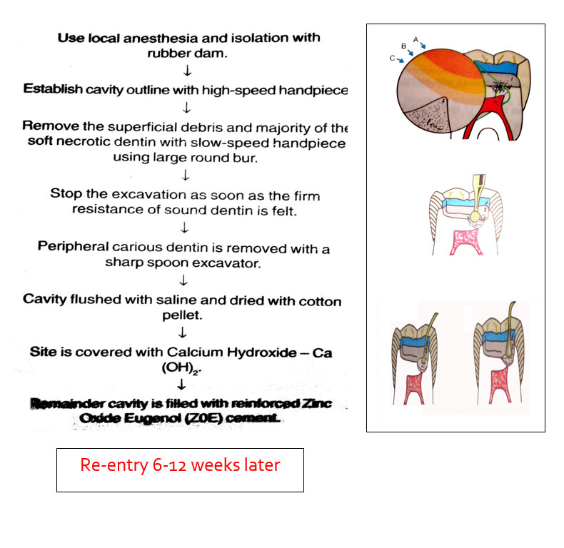 procedure