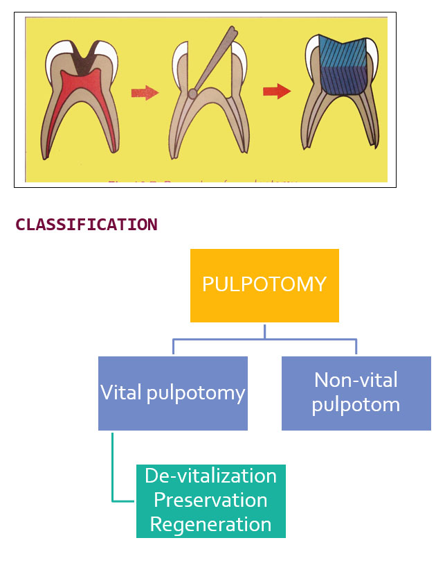 Pulp Therapy Focus Dentistry