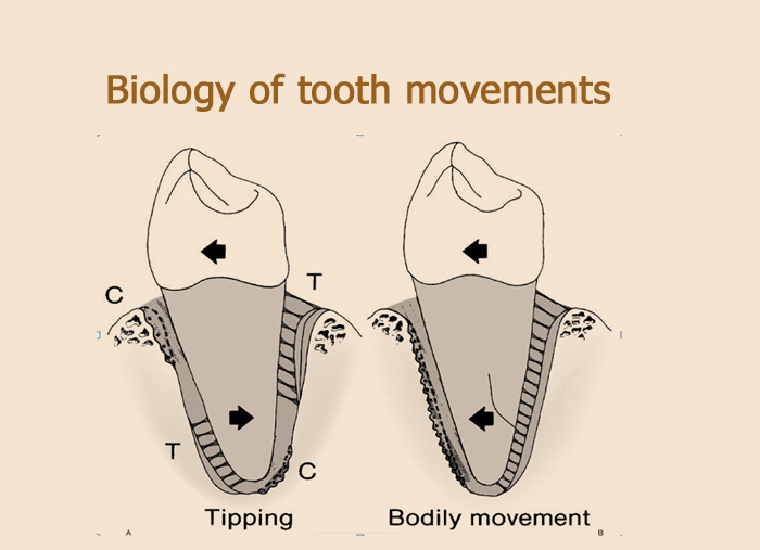 Phases Of Tooth Movement