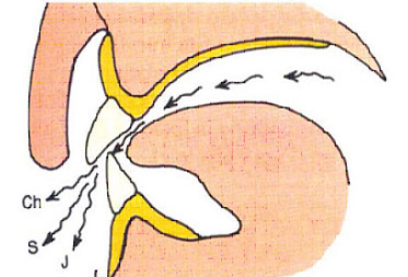 denture-2