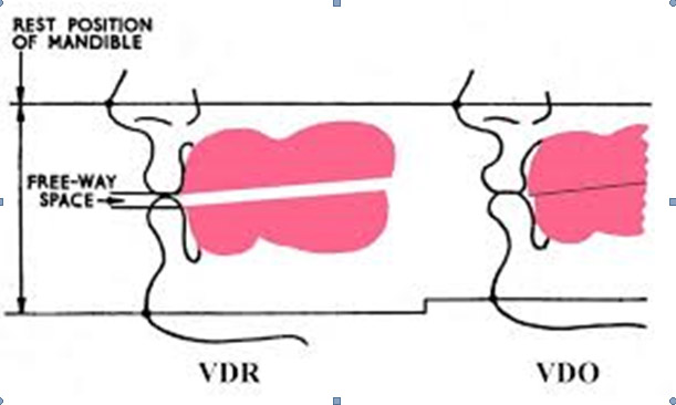 denture-2