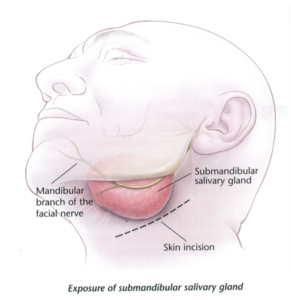 submandibular-gland