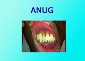 Anug - Focus Dentistry