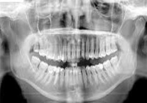 Extraoral Radiography-1