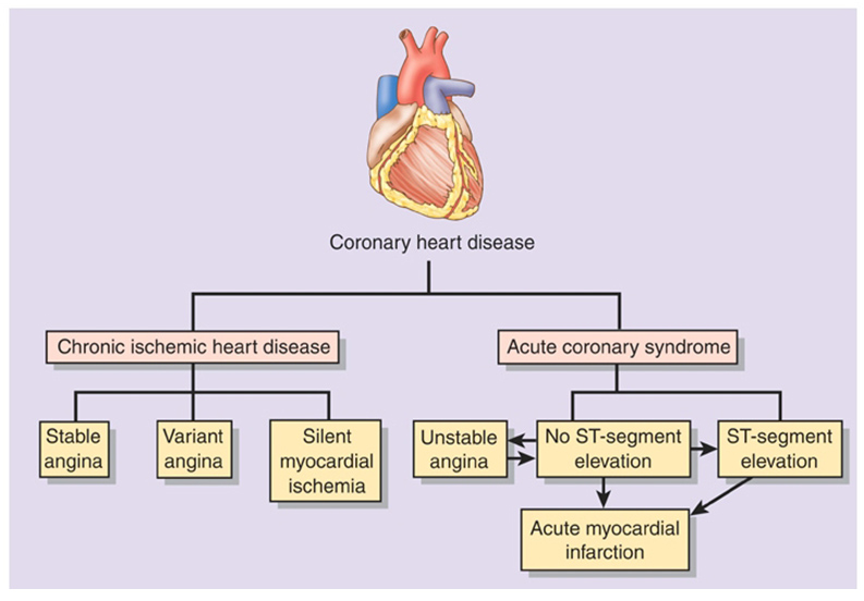 Coronary Artery Disease - Focus Dentistry