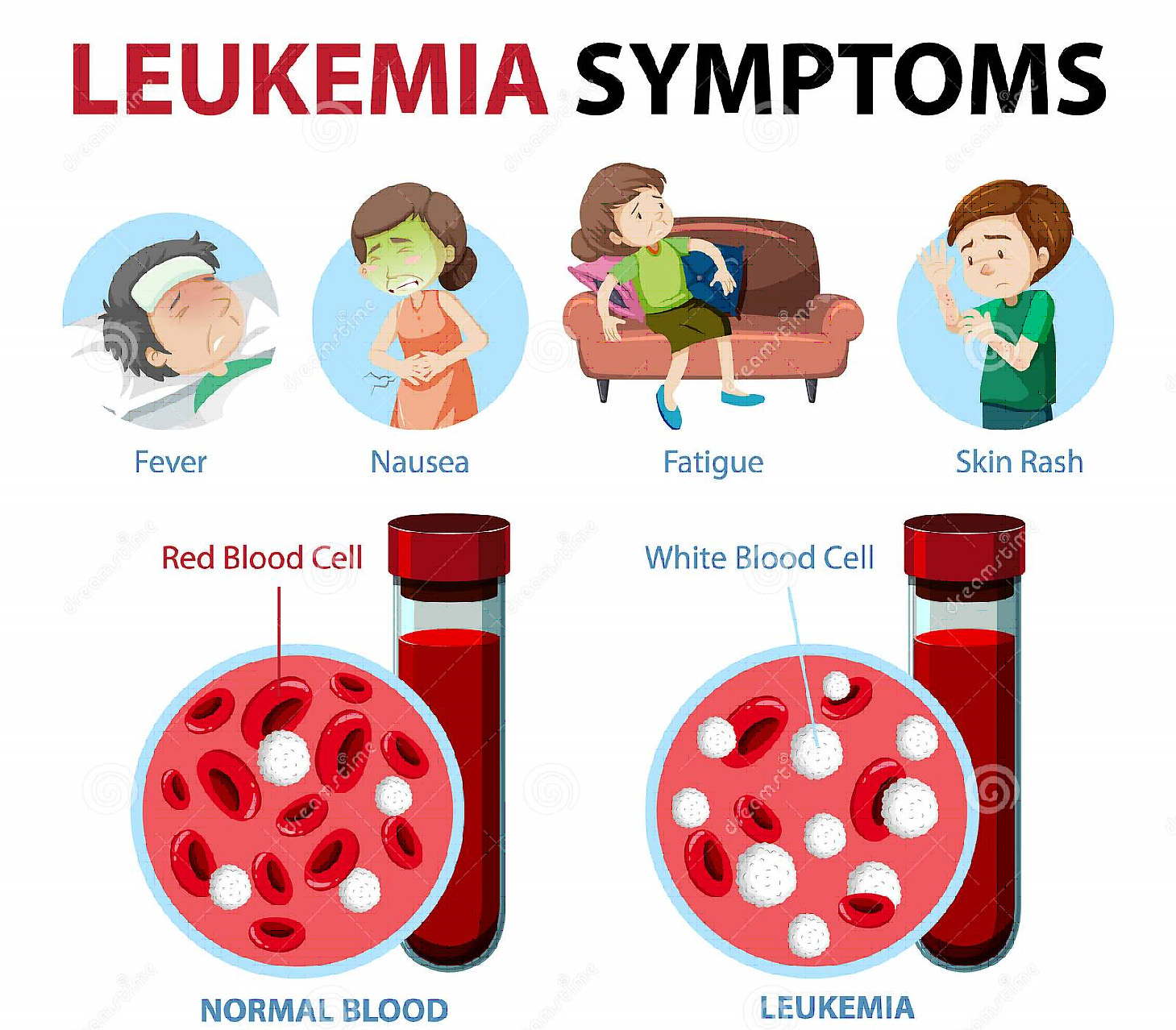 Leukemia - Focus Dentistry