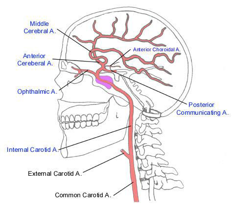 cerebral