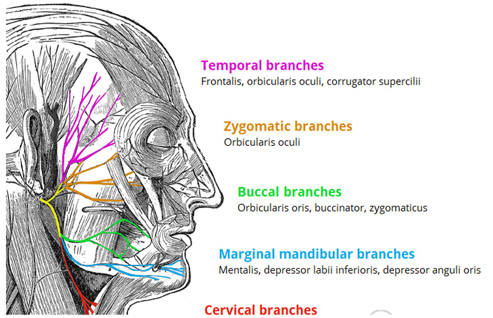 FACIAL NERVE_230227_063408-7