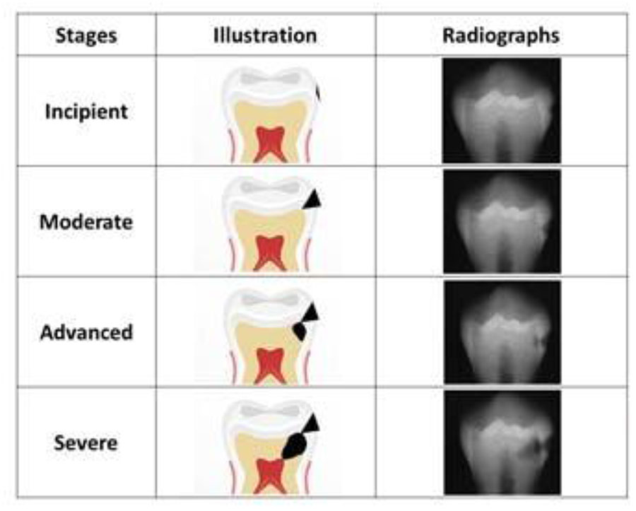 CLASSIFICATION ACCORDING TO SEVERITY