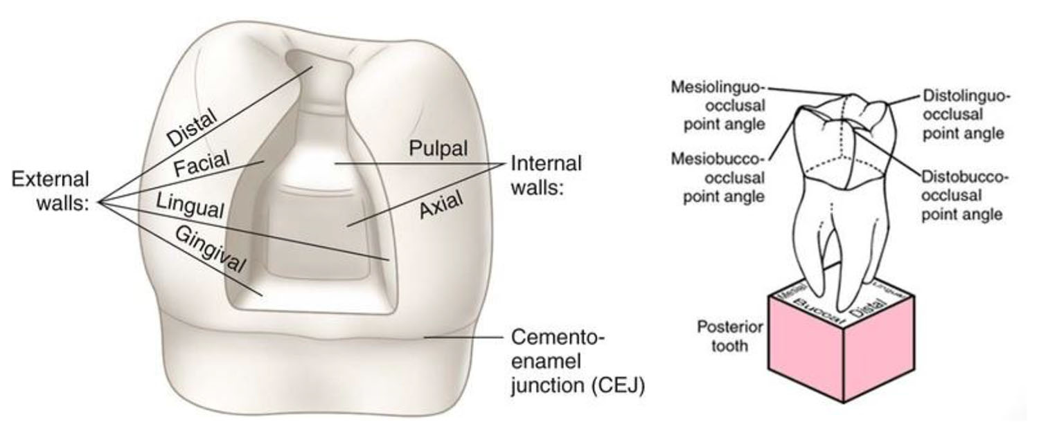 FUNDAMENTALS OF TOOTH PREPARATION part 1