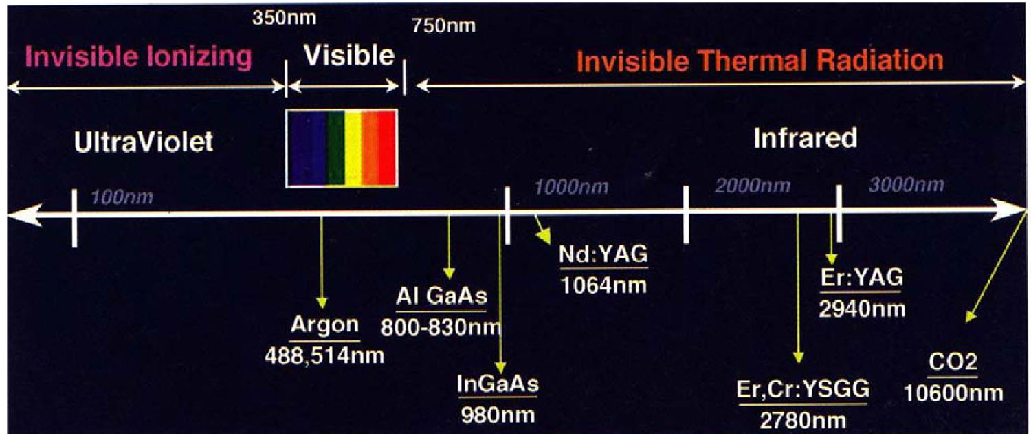 Types of laser