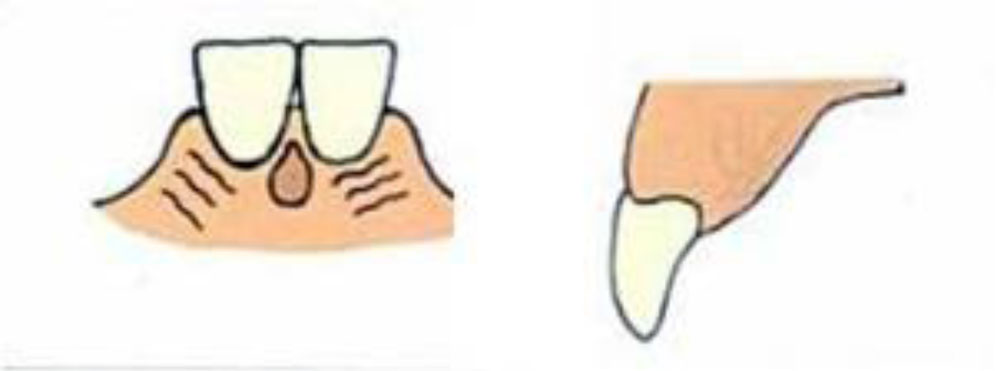 ANATOMICAL LANDMARKS MAXILLA_23jpg