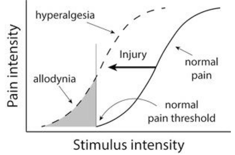 Allodynia