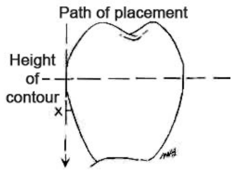 DENTAL SURVEYOR AND SURVEYING_4