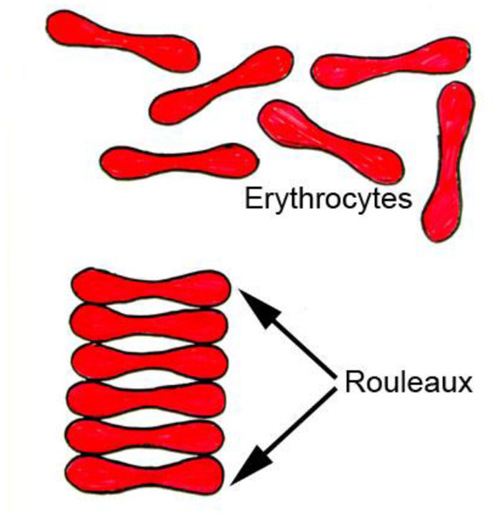 ESR_Mechanism