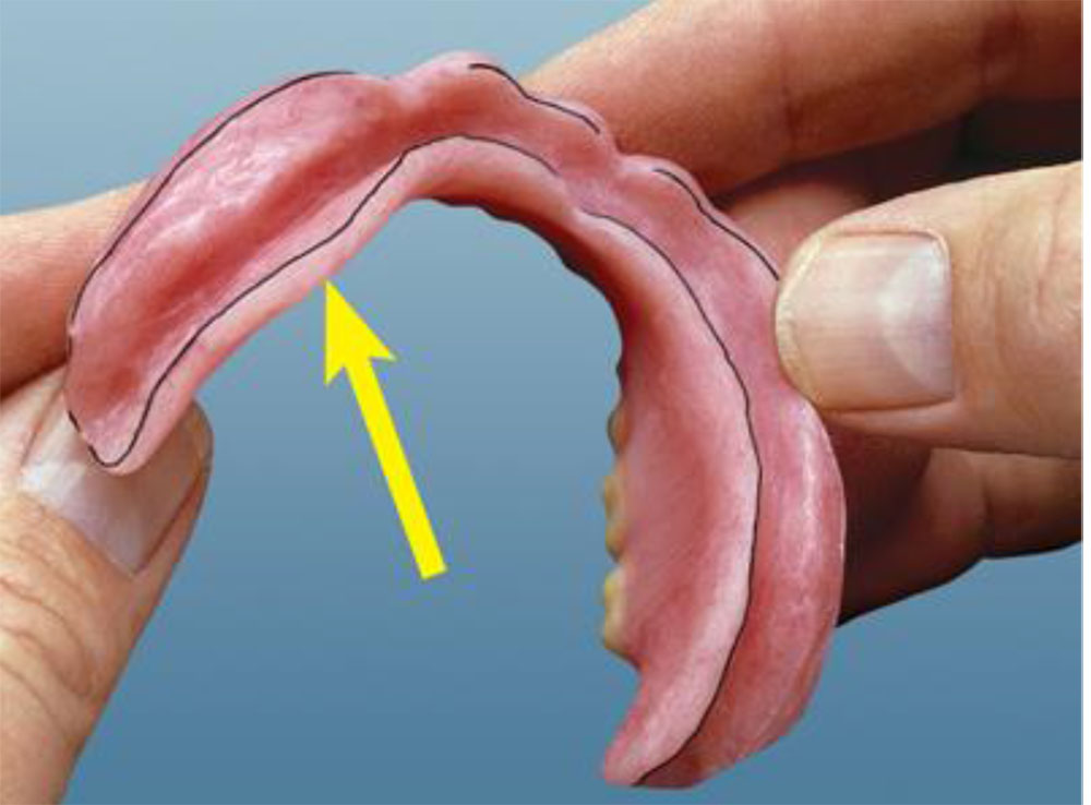 PAST PROSTHODONTICS MCQ DISCUSSION PART 2_2