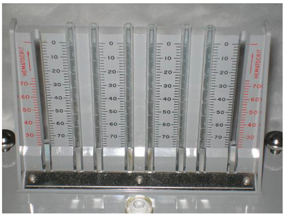 Westergren method