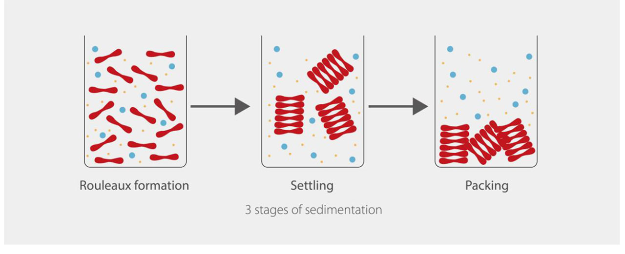 stages