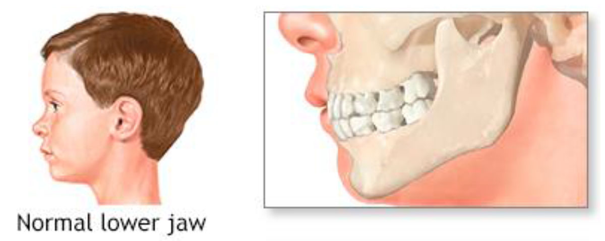 Few Past Dental Anatomy Questions Disscussion - Focus Dentistry