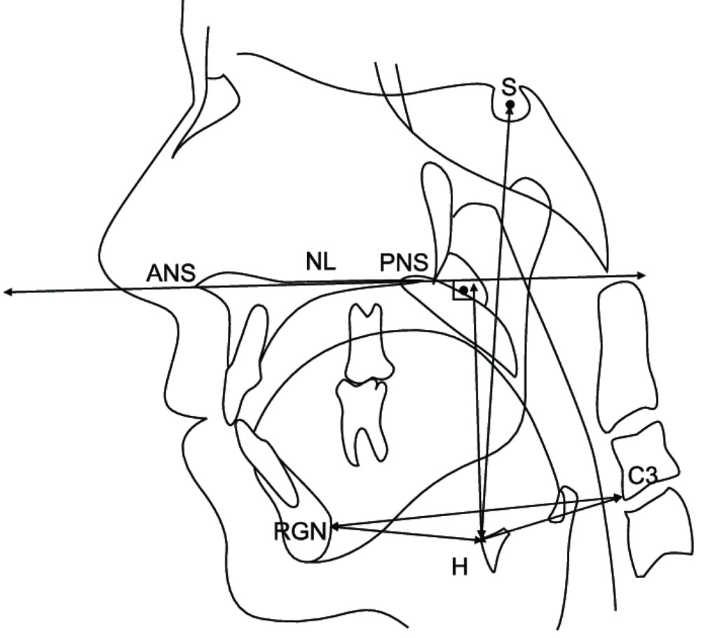 CEPHALOMETRIC LANDMARKS_4