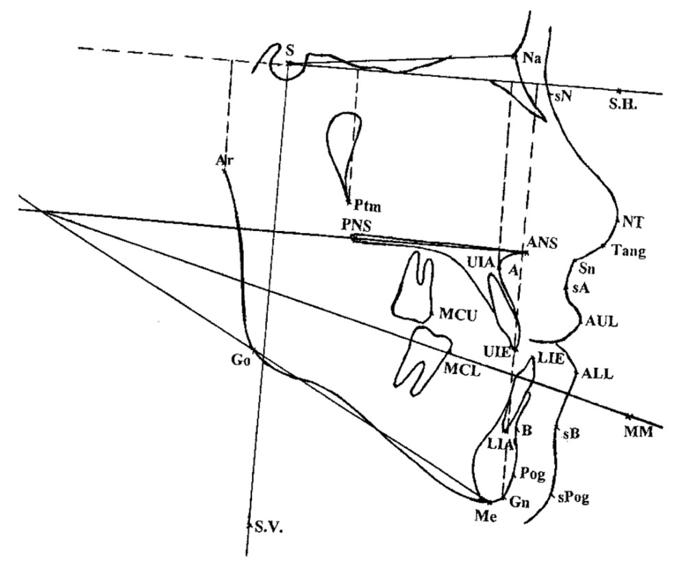 CEPHALOMETRIC LANDMARKS_5