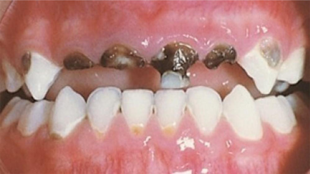 PAST ORAL PATHOLOGY MCQ-2