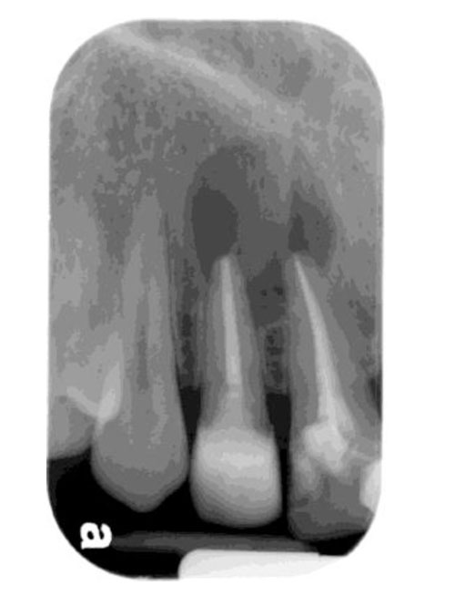 PAST ORAL PATHOLOGY QUESTIONS AND ANSWERS_1