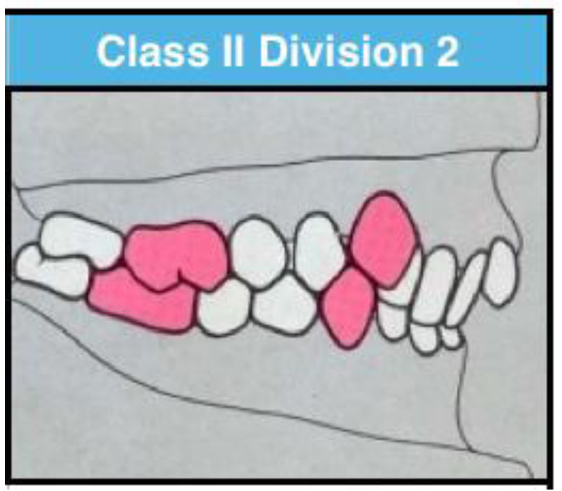 PAST ORTHODONTIC 4