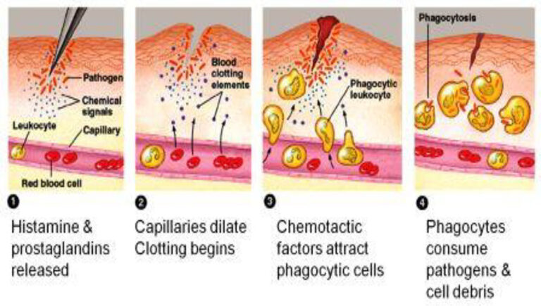 INFLAMMATION Focus Dentistry INFLAMMATION Focus Dentistry