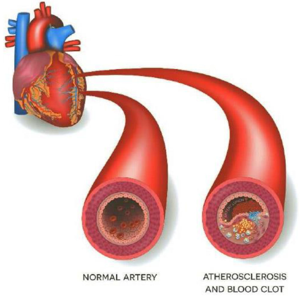 PAST GENERAL PATHOLOGY QUESTIONS AND DISSCUSSION_3