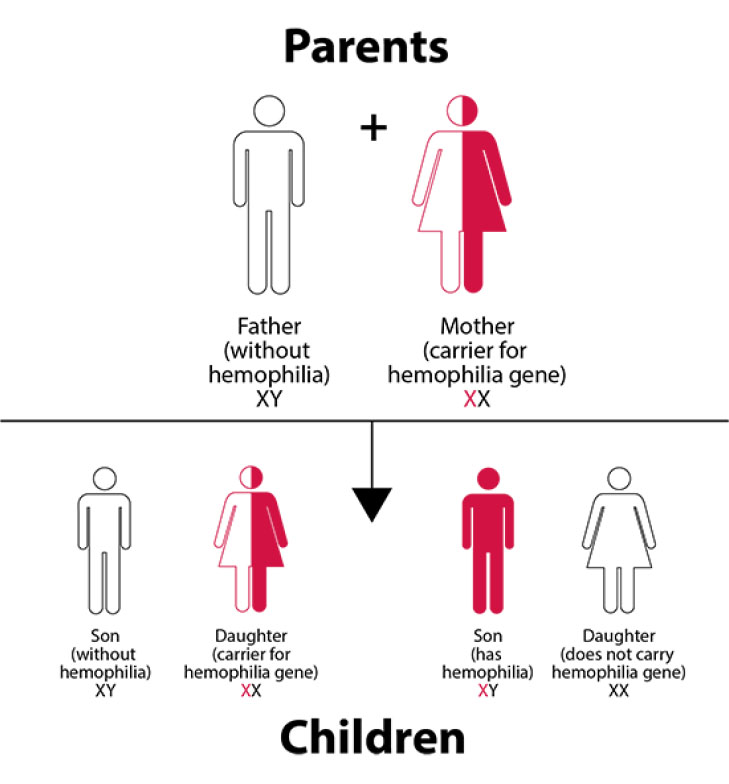 Hemophilia - Focus Dentistry