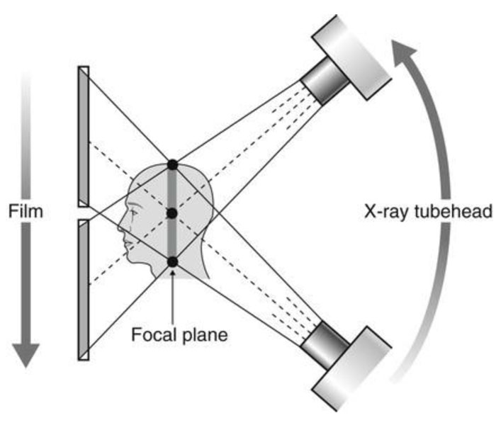 Conventional Tomography_3