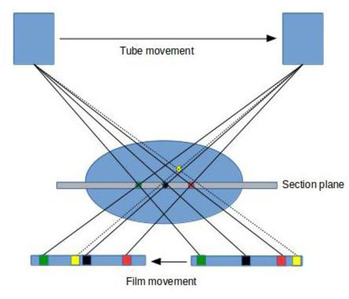 Conventional Tomography_4