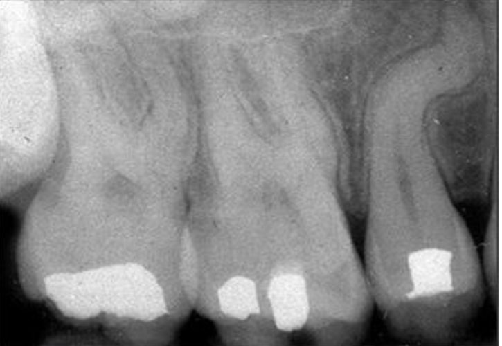 Radiographic Features