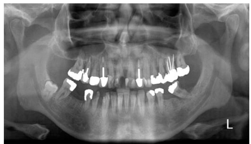 Uses in dentistry