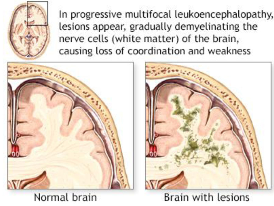 FEW PAST AIIMS QUESTIONS part 1_2