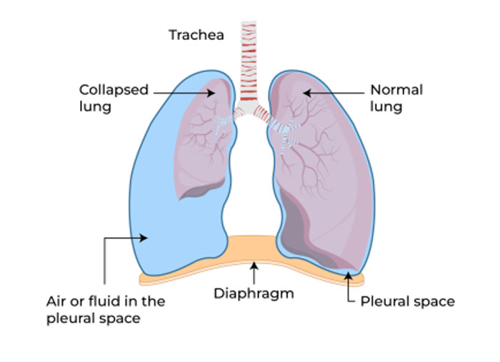 AIIMS SR SHIP QUESTIONS AND ANSWERS - Focus Dentistry