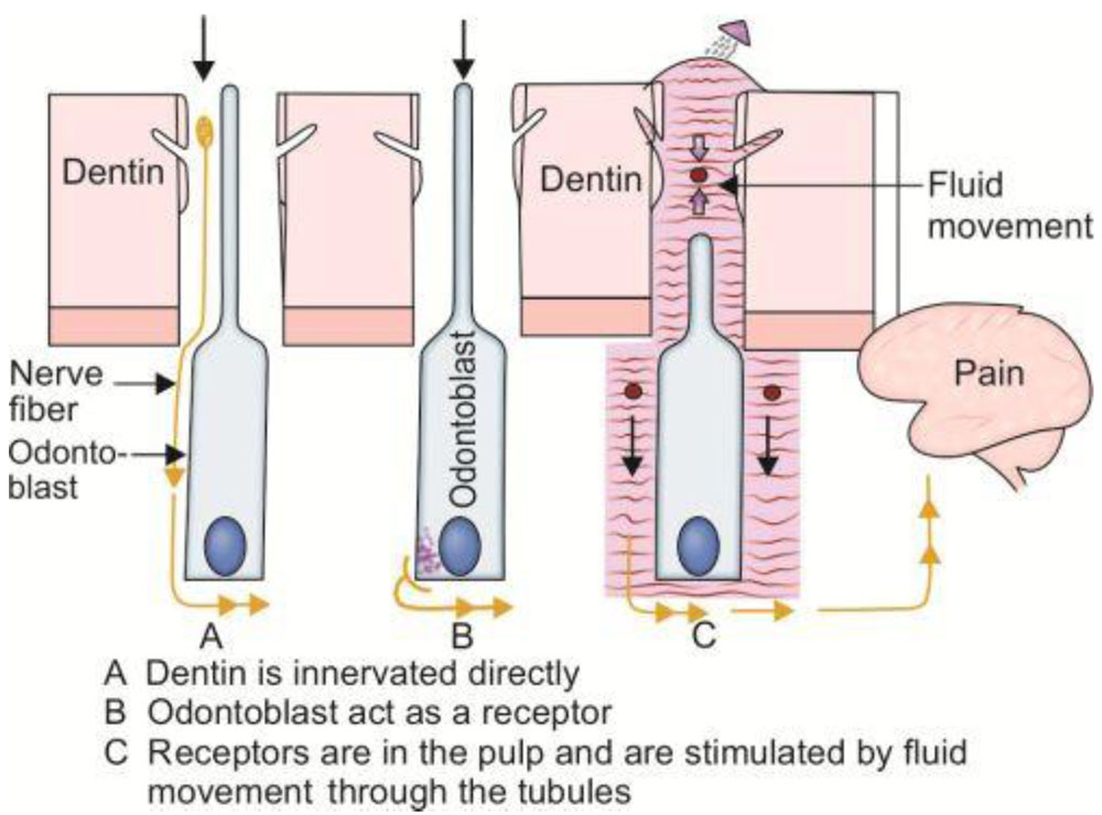 DENTIN SENSITIVITY THEORIES