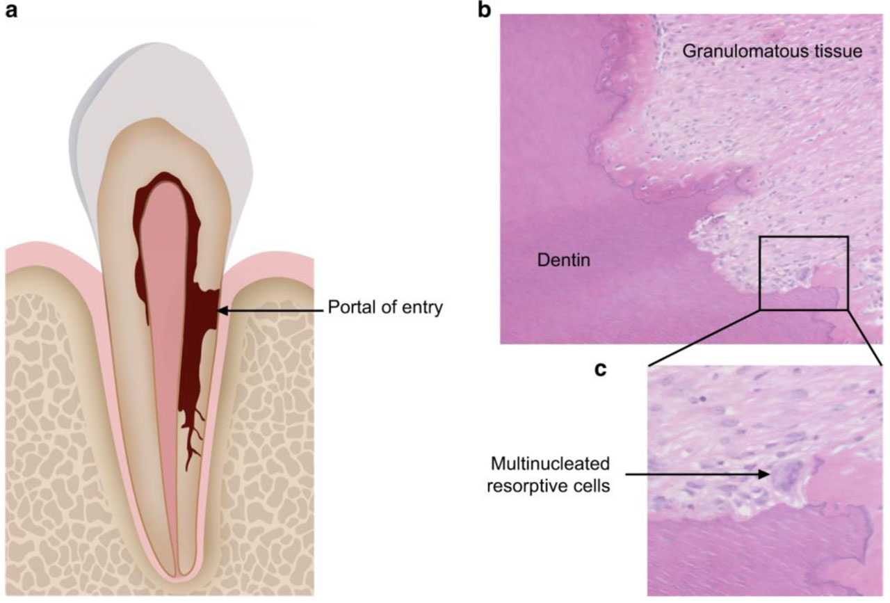 FEW MCQ ON DENTAL ANATOMY AND HISTOLOGY_