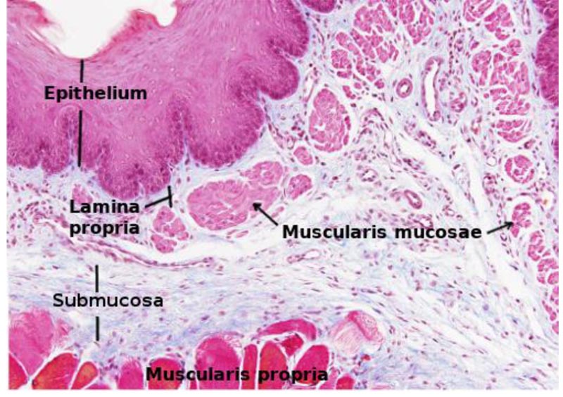 Stratified squamous non keratinized